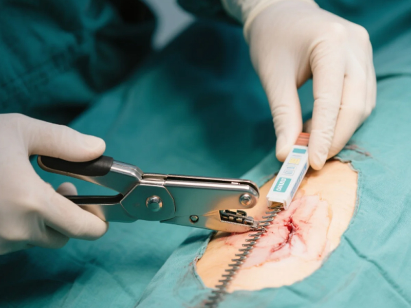 How-to-Use-a-Surgical-Stapler.jpg