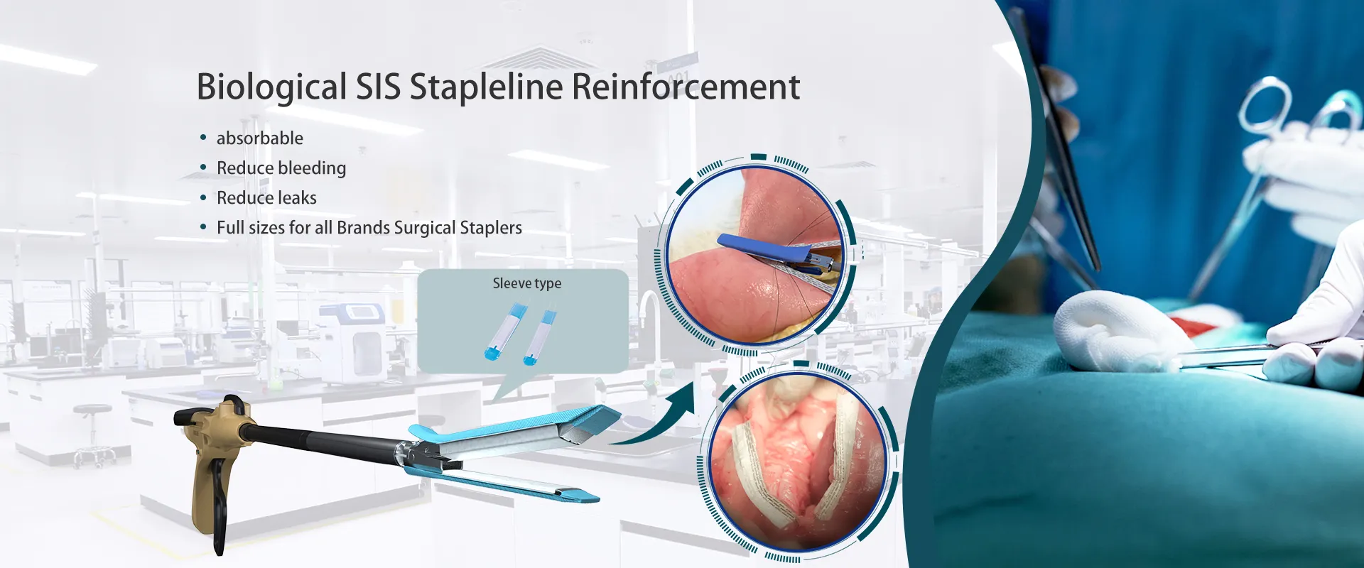 Biological SIS Stapleline Reinforcement